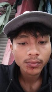 Jemput Pacar Malah Apes! Zibril Dihajar Hingga Pendarahan di Balaraja 2 WhatsApp Image 2025 10 19 at 18.23.45